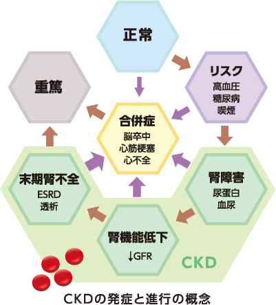 CKDの発症と進行の概念図